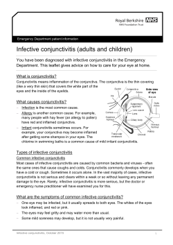Infective conjunctivitis - Royal Berkshire Hospital