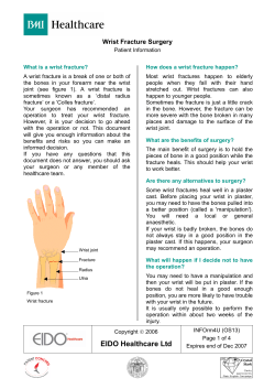 OS13 Wrist Fracture Surgery