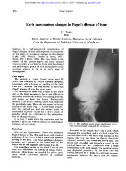 Early sarcomatous changes in Paget`s disease of bone