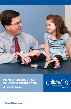 PonSETI METHod For CLUBFooT CorrECTIon