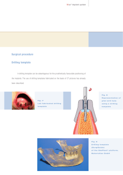 Surgical procedure - Servo