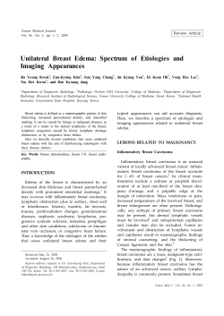 Unilateral Breast Edema