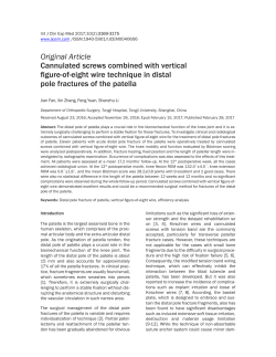 Cannulated screws combined with vertical figure-of