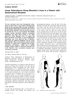 Linear Scleroderma Along Blaschko`s Lines in a Patient with