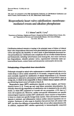 129 F.9. Schoen` and Calcification-induced stenosis or tearing is the