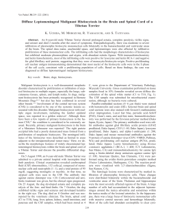 Diffuse Leptomeningeal Malignant Histiocytosis in the Brain and