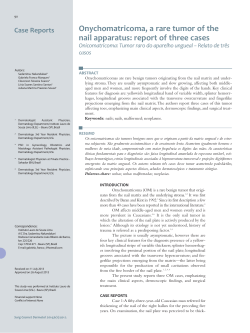 Onychomatricoma, a rare tumor of the nail apparatus: report of three