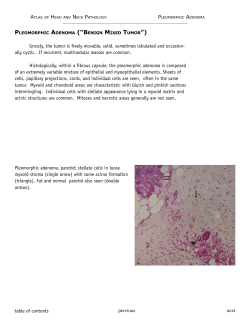 table of contents previous next Grossly, the tumor is freely movable