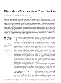 Diagnosis and Management of Tinea Infections