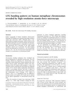 GTG banding pattern on human metaphase chromosomes revealed