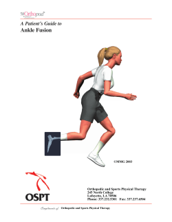 Ankle Fusion - Orthopedic and Sports Physical Therapy