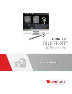 CT Scan Centers - Tornier BLUEPRINT