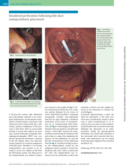 Duodenal perforation following bile duct endoprosthesis placement