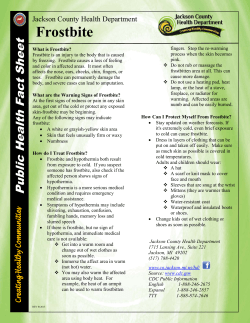 Frostbite - Jackson County, MI