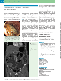 Aortobifemoral prosthesis penetrating the duodenal wall