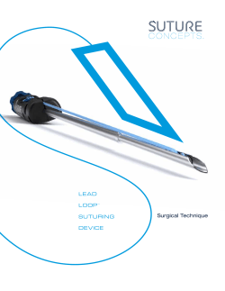 surgical guide - Suture Concepts
