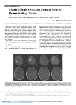 Multiple Brain Cysts: An Unusual Form of Demyelinating Disease