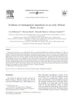 Evidence of amelogenesis imperfecta in an early African Homo