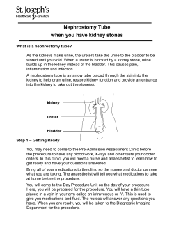 Nephrostomy Tube when you have kidney stones