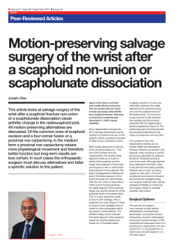 Motion-preserving salvage surgery of the wrist after a scaphoid non