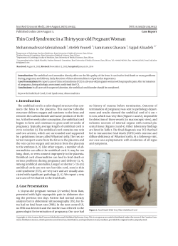 Thin Cord Syndrome in a Thirty-year