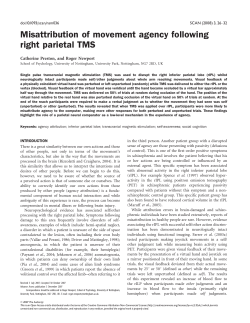 Misattribution of movement agency following right parietal TMS