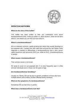 Keratoacanthoma - British Association of Dermatologists