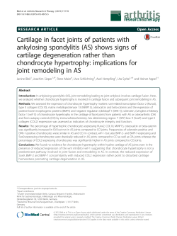 Cartilage in facet joints of patients with ankylosing spondylitis (AS