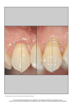 The International Journal of Periodontics