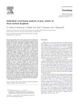 Individual voxel-based analysis of gray matter in focal
