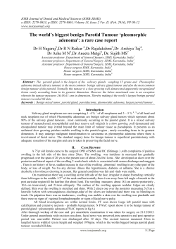The world`s biggest benign Parotid Tumour `pleomorphic adenoma