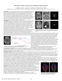 16:54 162. Addressing a Systematic Vibration Artefact in Diffusion