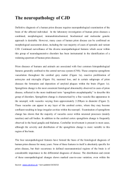 The neuropathology of CJD