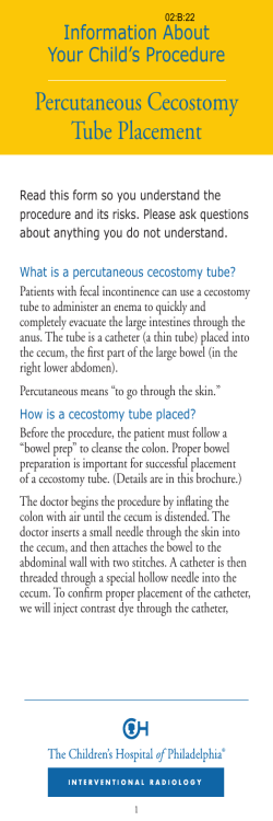 Percutaneous Cecostomy Tube Placement