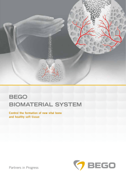 bego biomaterial system