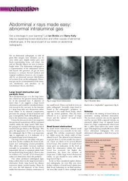 Abdominal x rays made easy: abnormal intraluminal gas