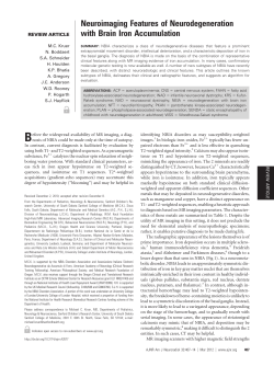 Neuroimaging Features of Neurodegeneration with Brain Iron