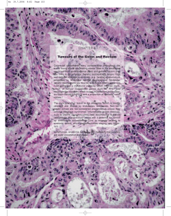 CHAPTER 6 Tumours of the Colon and Rectum