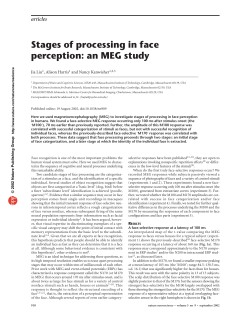 Stages of processing in face perception: an MEG