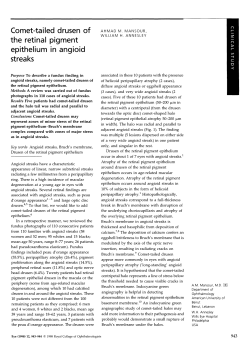 Comet-tailed drusen of the retinal pigment epithelium in