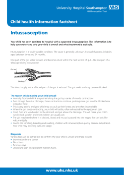 Intussusception - patient information