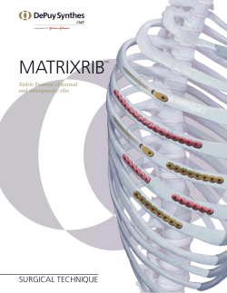 MatrixRIB Technique Guide