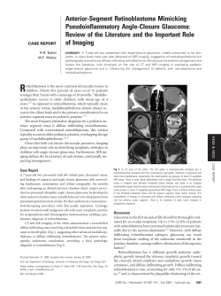 Anterior-Segment Retinoblastoma Mimicking Pseudoinflammatory