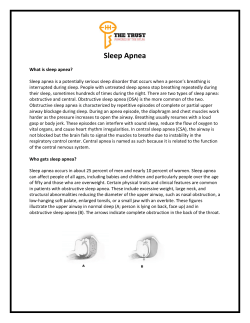 Sleep Apnea - NFL Players Trust