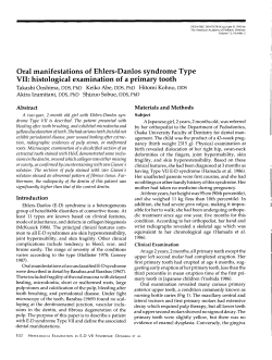 Oral manifestations of Ehlers-Danlos syndrome Type VII