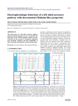 Electrophysiologic behaviour of a left sided accessory pathway with