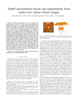 Depth discontinuity-based cup segmentation from multi