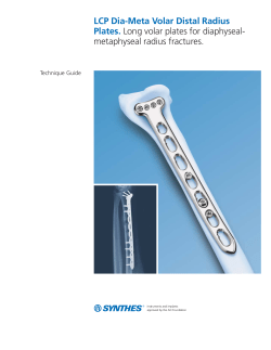 LCP Dia-Meta Volar Distal Radius Plates Technique Guide