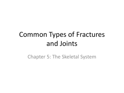 Common Types of Fractures - Flushing Community Schools
