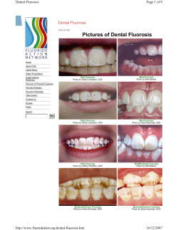 Pictures of Dental Fluorosis